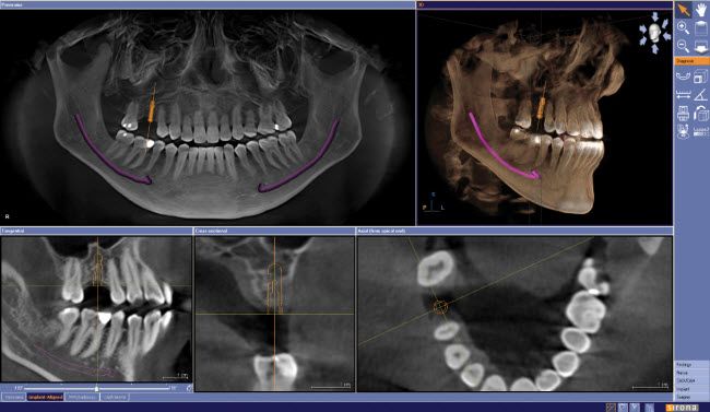 dental imaging technology