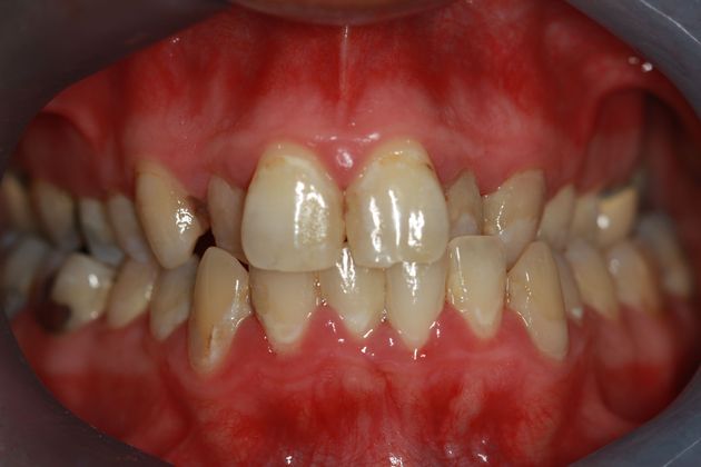 Before smile makeover